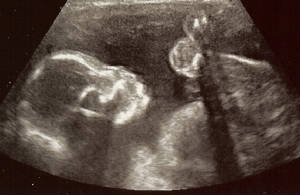 12-16-08babyprofile.jpg