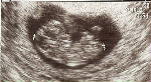 baby10weeks.jpg