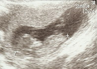 baby12weeks.jpg